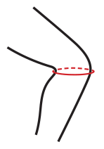 1)
