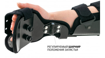 Регулятор поворота предплечья